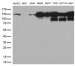 CDH1 Antibody in Western Blot (WB)