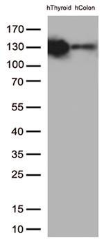 CDH1 Antibody in Western Blot (WB)