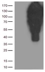 CDH1 Antibody in Western Blot (WB)