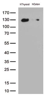 CDH1 Antibody in Western Blot (WB)