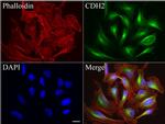 CDH2 Antibody in Immunocytochemistry (ICC/IF)