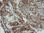 CDH2 Antibody in Immunohistochemistry (Paraffin) (IHC (P))