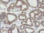 CDH2 Antibody in Immunohistochemistry (Paraffin) (IHC (P))