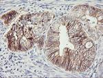 CDH2 Antibody in Immunohistochemistry (Paraffin) (IHC (P))