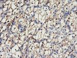 CDH2 Antibody in Immunohistochemistry (Paraffin) (IHC (P))