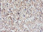 CDH2 Antibody in Immunohistochemistry (Paraffin) (IHC (P))