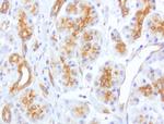 CDH2 Antibody in Immunohistochemistry (Paraffin) (IHC (P))