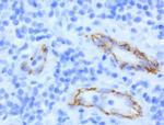 CDH2 Antibody in Immunohistochemistry (Paraffin) (IHC (P))