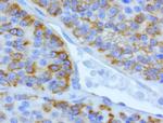 CDH2 Antibody in Immunohistochemistry (Paraffin) (IHC (P))