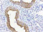 CDH2 Antibody in Immunohistochemistry (Paraffin) (IHC (P))