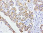 CDH2 Antibody in Immunohistochemistry (Paraffin) (IHC (P))