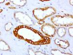 CDH2 Antibody in Immunohistochemistry (Paraffin) (IHC (P))