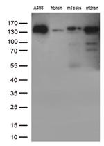 CDH2 Antibody in Western Blot (WB)