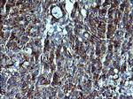 CDH3 Antibody in Immunohistochemistry (Paraffin) (IHC (P))