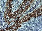 CDH3 Antibody in Immunohistochemistry (Paraffin) (IHC (P))