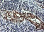 CDH3 Antibody in Immunohistochemistry (Paraffin) (IHC (P))