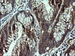 CDH3 Antibody in Immunohistochemistry (Paraffin) (IHC (P))