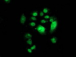 CDK2 Antibody in Immunocytochemistry (ICC/IF)