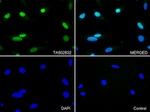 CDK2 Antibody in Immunocytochemistry (ICC/IF)