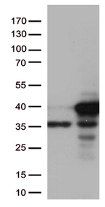 CDK2 Antibody in Western Blot (WB)