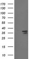 CDK2 Antibody in Western Blot (WB)