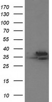 CDK2 Antibody in Western Blot (WB)