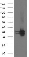 CDK2 Antibody in Western Blot (WB)