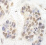 CDK8 Antibody in Immunohistochemistry (IHC)