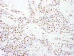 CDK9 Antibody in Immunohistochemistry (IHC)