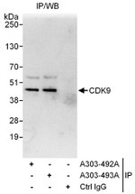 CDK9 Antibody in Immunoprecipitation (IP)