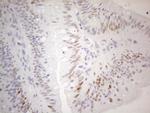 CDKN1A Antibody in Immunohistochemistry (Paraffin) (IHC (P))