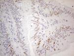 CDKN1A Antibody in Immunohistochemistry (Paraffin) (IHC (P))