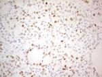 CDKN1A Antibody in Immunohistochemistry (Paraffin) (IHC (P))