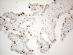 CDKN1A Antibody in Immunohistochemistry (Paraffin) (IHC (P))