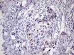 CDKN1A Antibody in Immunohistochemistry (Paraffin) (IHC (P))