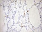 CDKN2A Antibody in Immunohistochemistry (Paraffin) (IHC (P))