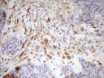 CDKN2A Antibody in Immunohistochemistry (Paraffin) (IHC (P))