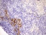 CDKN2A Antibody in Immunohistochemistry (Paraffin) (IHC (P))