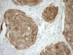 CDKN2A Antibody in Immunohistochemistry (Paraffin) (IHC (P))