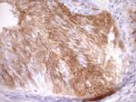 CDKN2A Antibody in Immunohistochemistry (Paraffin) (IHC (P))