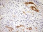 CDKN2A Antibody in Immunohistochemistry (Paraffin) (IHC (P))