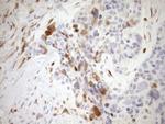 CDKN2A Antibody in Immunohistochemistry (Paraffin) (IHC (P))