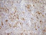 CDKN2A Antibody in Immunohistochemistry (Paraffin) (IHC (P))