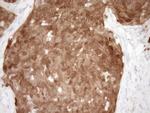 CDKN2A Antibody in Immunohistochemistry (Paraffin) (IHC (P))