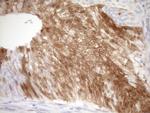 CDKN2A Antibody in Immunohistochemistry (Paraffin) (IHC (P))