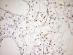 CDKN2A Antibody in Immunohistochemistry (Paraffin) (IHC (P))