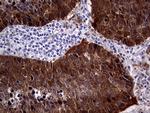 CDKN2A Antibody in Immunohistochemistry (Paraffin) (IHC (P))