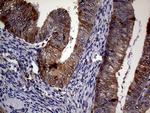 CDKN2A Antibody in Immunohistochemistry (Paraffin) (IHC (P))