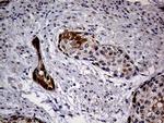 CDKN2A Antibody in Immunohistochemistry (Paraffin) (IHC (P))