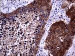 CDKN2A Antibody in Immunohistochemistry (Paraffin) (IHC (P))